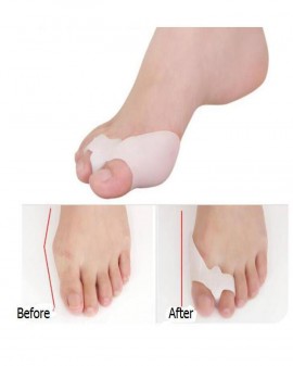 Bộ 2 miếng bảo vệ đinh hình ngón chân cái , tách ngón chân Silicon ( Nhỏ)